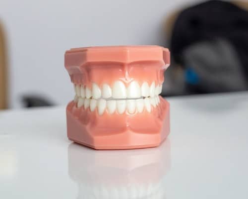 Teeth Treatment by Smiling Teeth