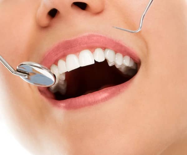 cosmetic dental treatment at the cosmetic dental clinic