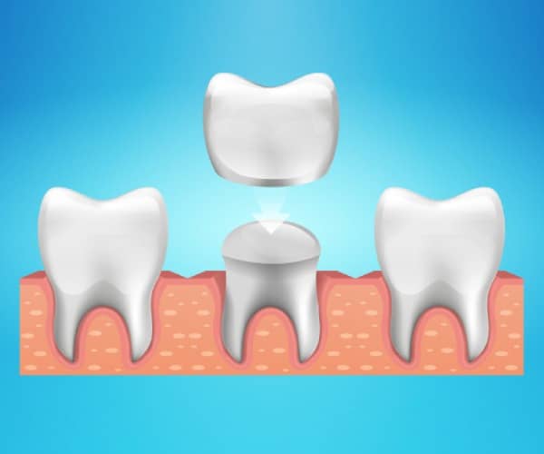 cosmetic dental treatment at the cosmetic dental clinic