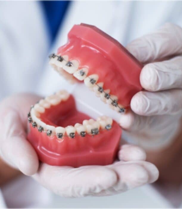 orthodontist doctor in Mira Road